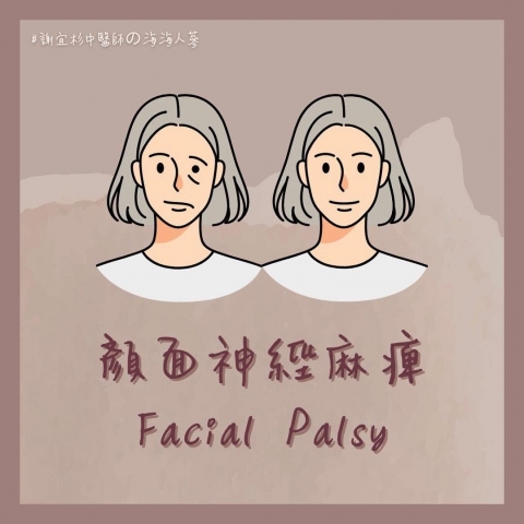 顏面神經痲痺