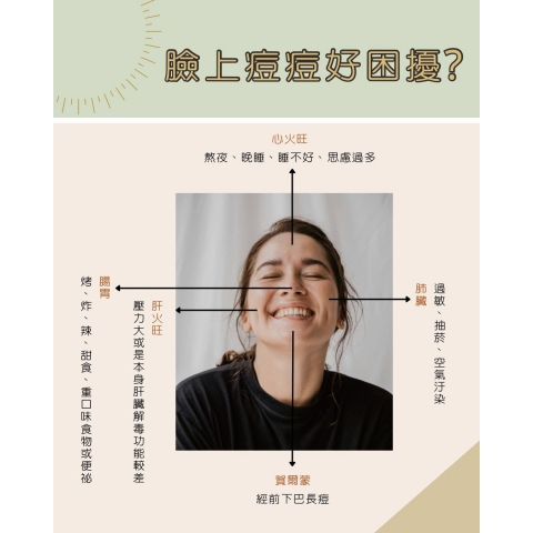 臉上痘痘好難搞